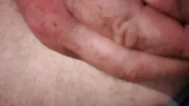 موی سرخ مقعد انجمن س ...